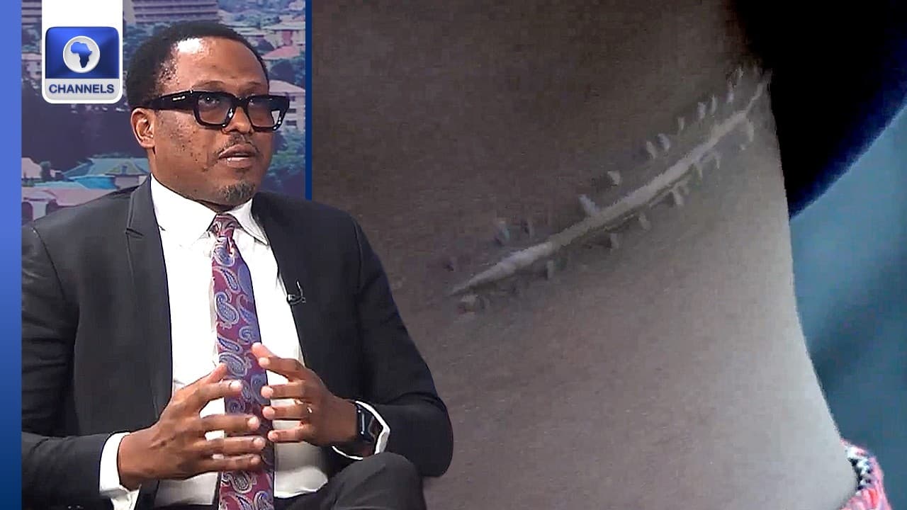 Abuja Kidney Harvesting Scandal: What Does the Law Really Say? | Dateline Abuja